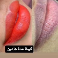 mimitta3220