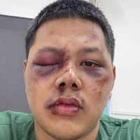 เสียงต้นฉบับ - ชายแท้เล็บเจล