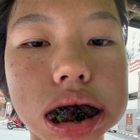 เสียงต้นฉบับ - อาหมอย ที่โดนรุมงัย ฯ.💅🏻🌷