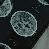 suara asli - Sobat Radiology