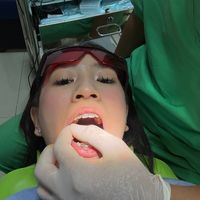 yoursecondoptionalways