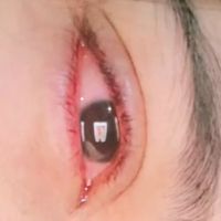 zoee.855