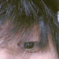 endo.xz