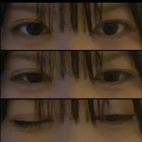 mon_chxnn
