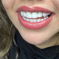 hasnaa.smile