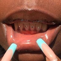 toothgemske0