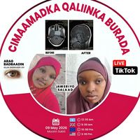 amirasomalia