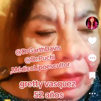 laabuea8