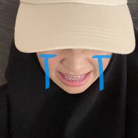 anachaya_ms