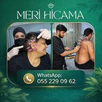 meri_hicama_sumqayit