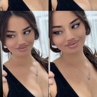 aulonabl1