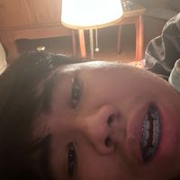 naprxss