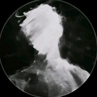 injury.jorh