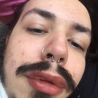 licentrismo