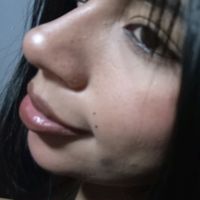 abilyd_rom10