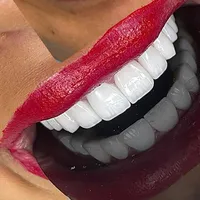 original sound - alhassandentalcenter