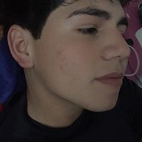 albertoomedina