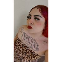 anaalberdin2