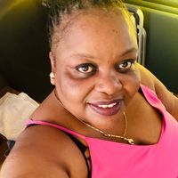 jolleynoases5