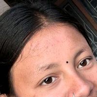 laxudhiru1