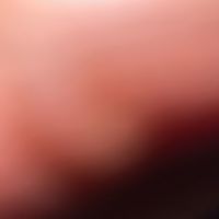 original sound - kAll44444