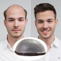 criuswig_toupee