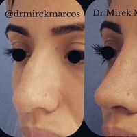 drmirekmarcos