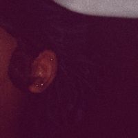 simp.4._lasco