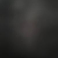 xmad_lol