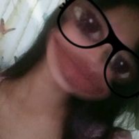 original sound - Renalyncalub12