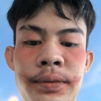 เสียงต้นฉบับ - ອາຍທດ ຕະມຕະມ