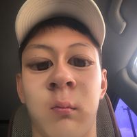 atedxve