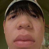 anhchonoday