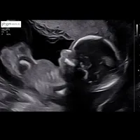 original sound - its_colbieee