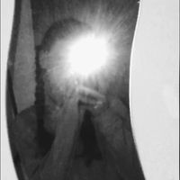 _lillyliebtdich_