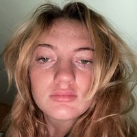 freckleface333