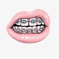 beautyfashionbraces_