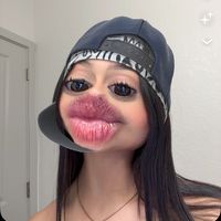 valpg