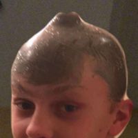 baldwinballin