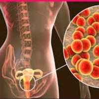 dictorafatimealhadji0