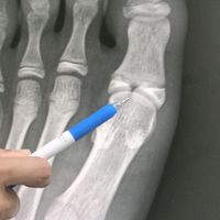 原聲 - 名字太長就會有白癡跟著唸🌚