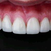 espinozacardona_odonto