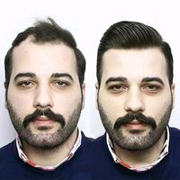 hairfixkosove