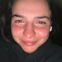 mylouxe