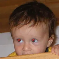 breezeblocks x take a slice