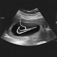 set dj w 6 don juan parte removida