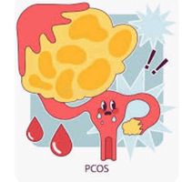 pcoscysters1