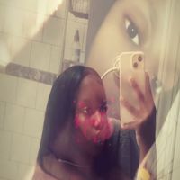 kissestoadarkskinyop