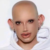 jamescharlessisbald