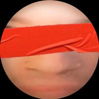 A car a torch a death